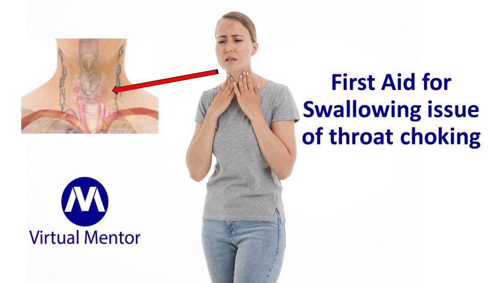 First Aid for Swallowing issue of throat choking